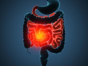 Entzündliche Darmerkrankung